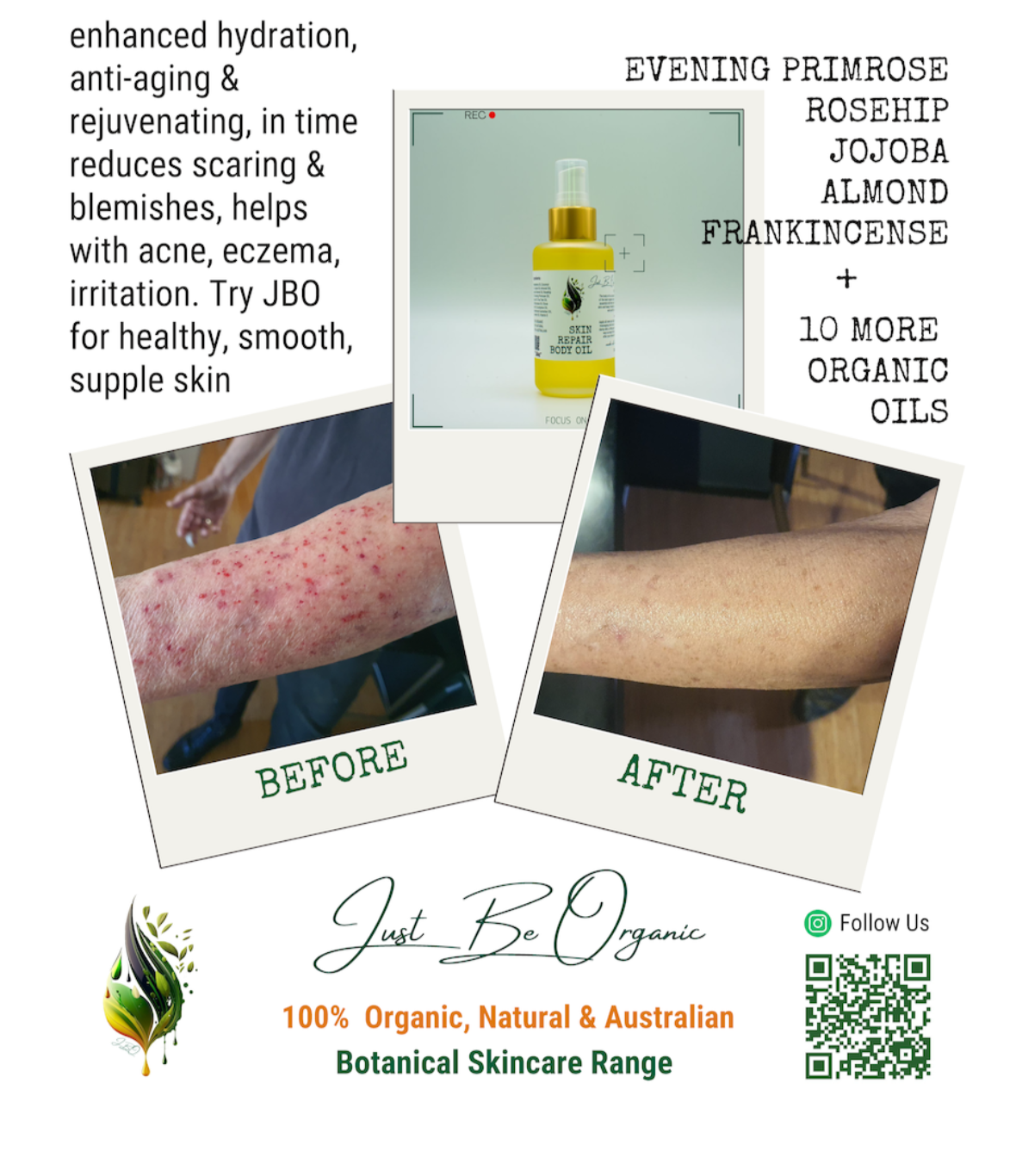 Skin Rejuvenation Body Oil (100ml)